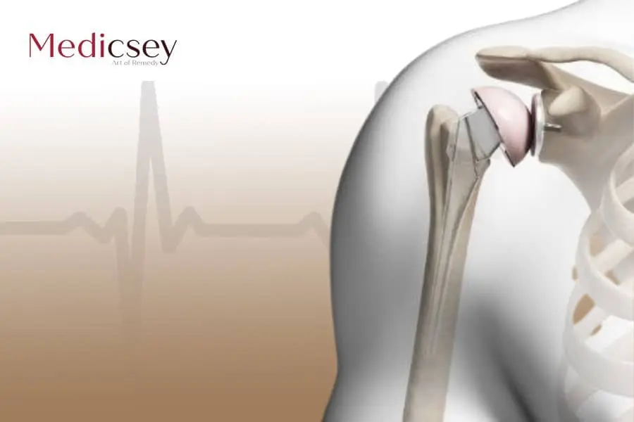 shoulder joint replacement in Turkey