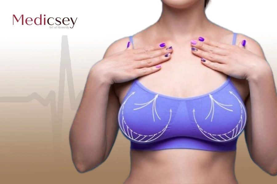 Learn All About Breast Reduction in Istanbul