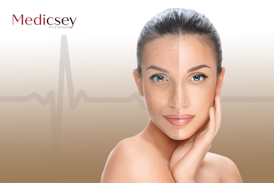 Laser skin rejuvenation in Turkey