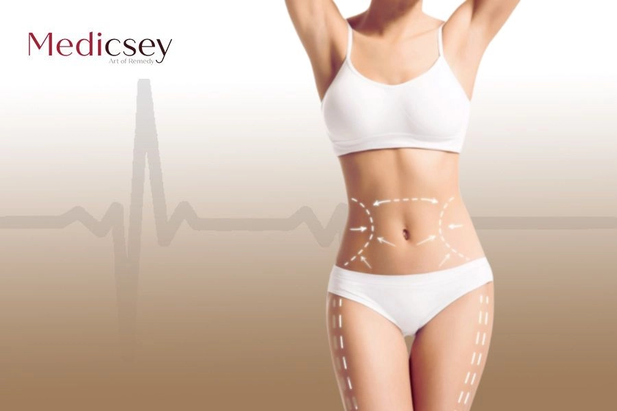 Liposuction Cost in Turkey: The Cheapest Options in 2023