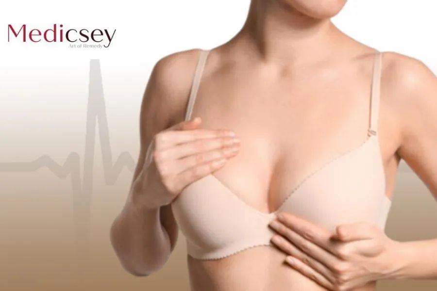 Breast Lift Price in Turkey: Exploring the Cost in 2024