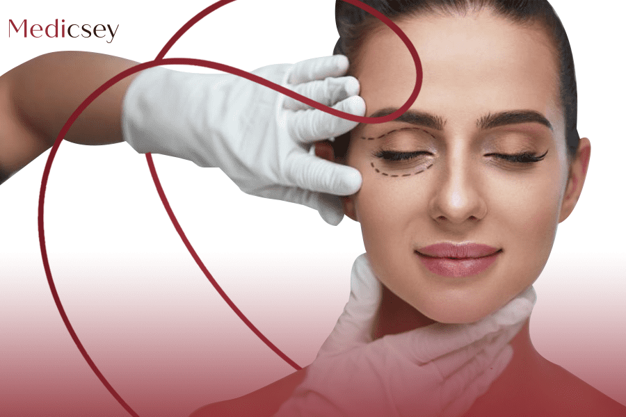 Eyelid Surgery in İstanbul