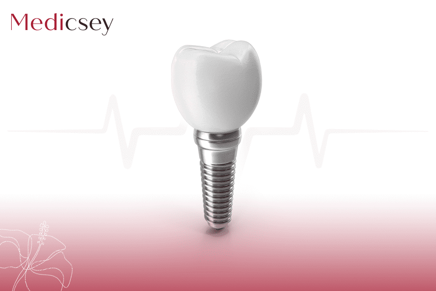 Istanbul Dental Implants Price