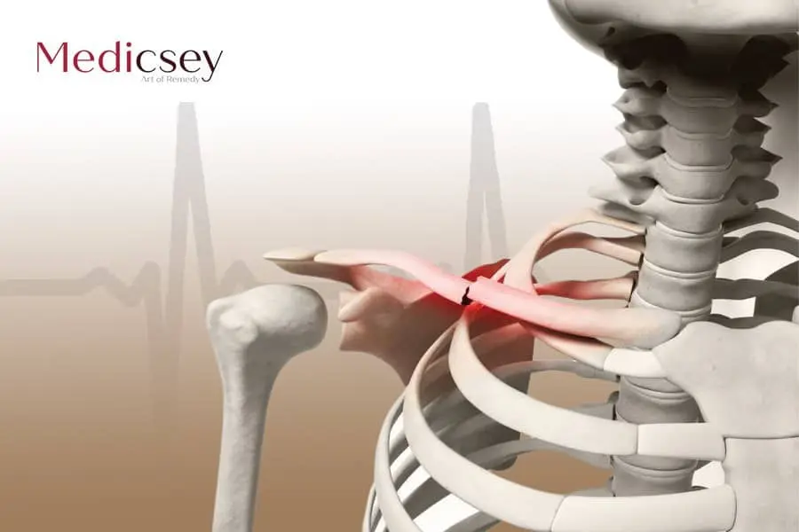 Causes and treatment of bone fractures in Turkey