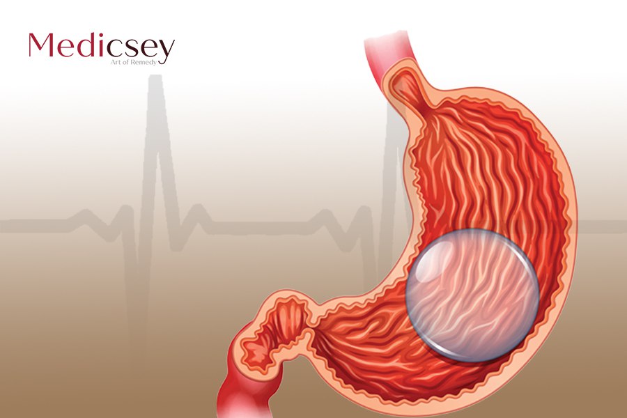 Procedures after removing the Turkey gastric balloon